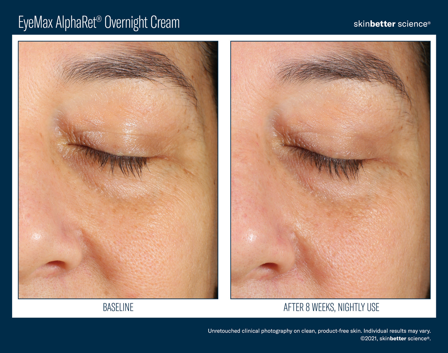 Eyemax™ AlphaRet® Overnight Cream